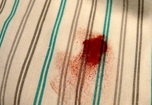 Удаление пятен крови с ковров и одежды: действенные методы